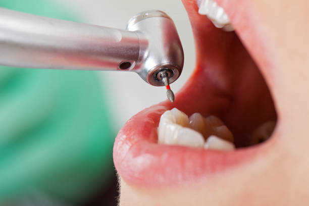 Best Walk-In Emergency Dental Services in Green Valley, CA